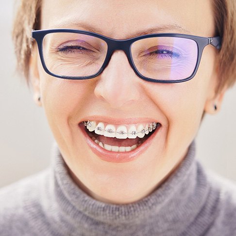 Woman smiling with traditional metal braces 