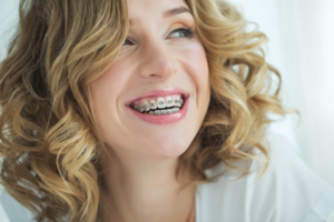Woman with braces smiling and looking off to the side