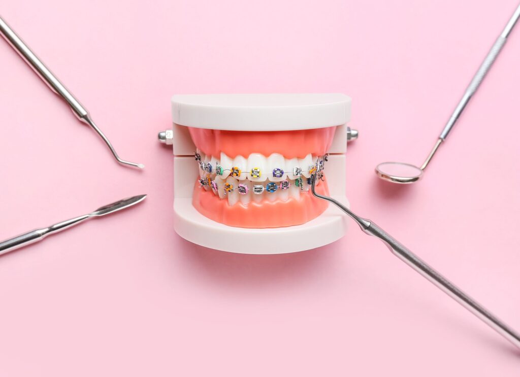 Model teeth with braces surrounded by 4 dental instruments on pink background